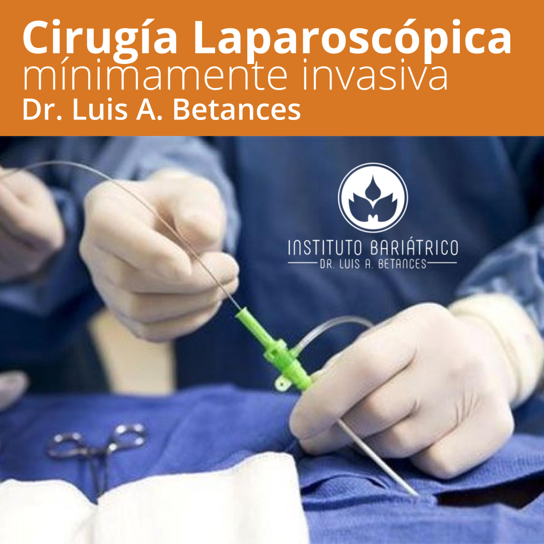 Dr. Luis A. Betances, Cirugía Laparoscópica o mínimamente invasiva | Medii