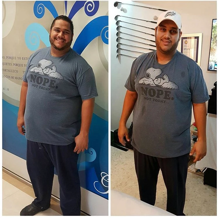 Testimonials, Juan Carlos Pichardo | Dr. Luis A. Betances, Bariatric Surgeon, Santo Domingo, Dominican Republic